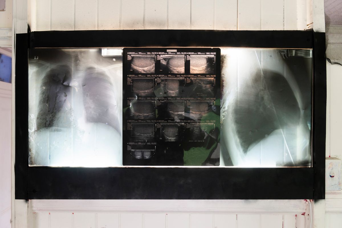 Archie Moore: HouseShow